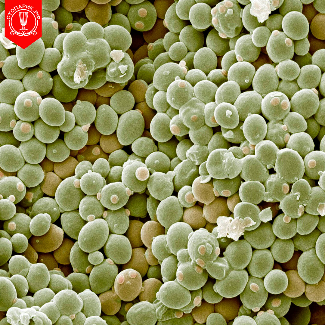 Дрожжи грибы. Пекарские дрожжи Saccharomyces cerevisiae. Микроскопирование Saccharomyces cerevisiae. Saccharomyces oviformis. Saccharomyces cerevisiae микроскоп.